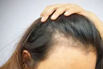 ویتامین B6 و تاثیر آن بر سلامت و حجم موها